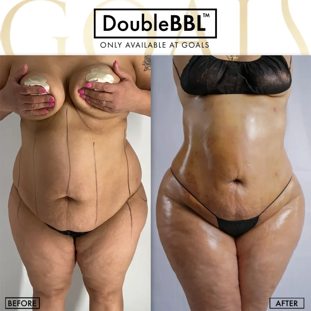 Before and after, patient 1