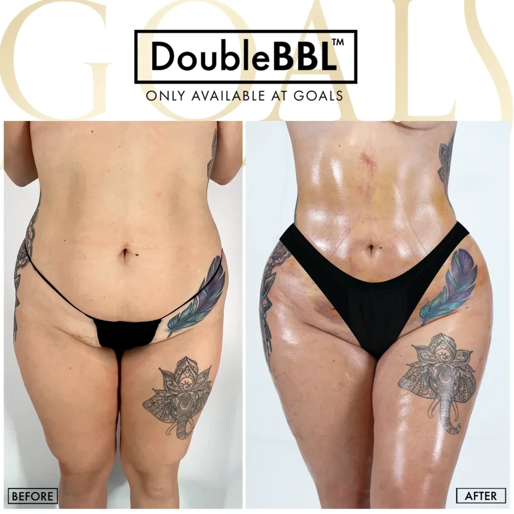 Before and after, patient 2