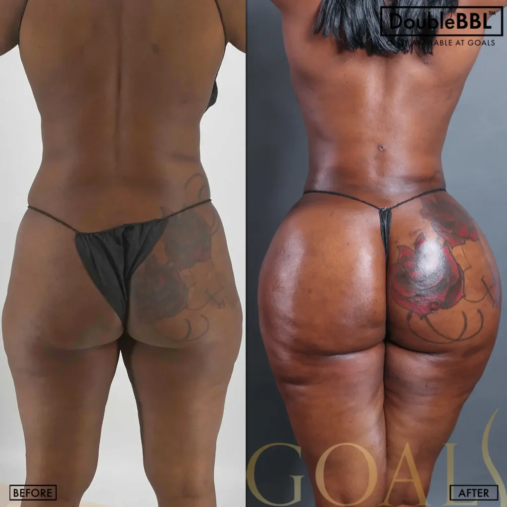 Before and after, patient 3