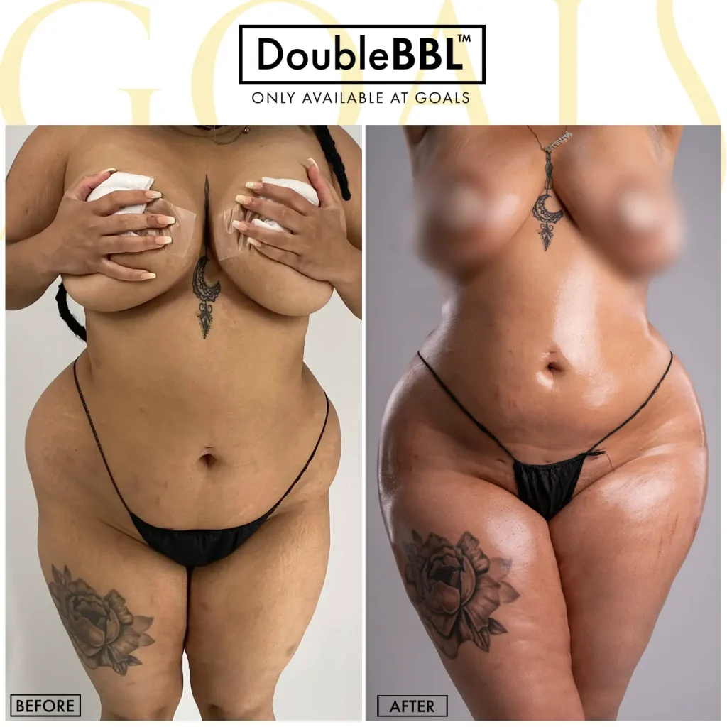 Before and after, patient 4