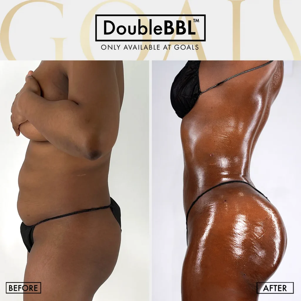 Before and after, patient 5