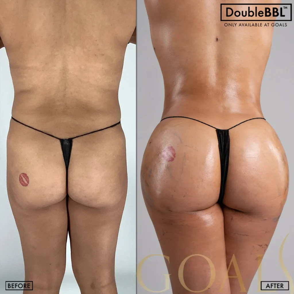 Before and after, patient 6