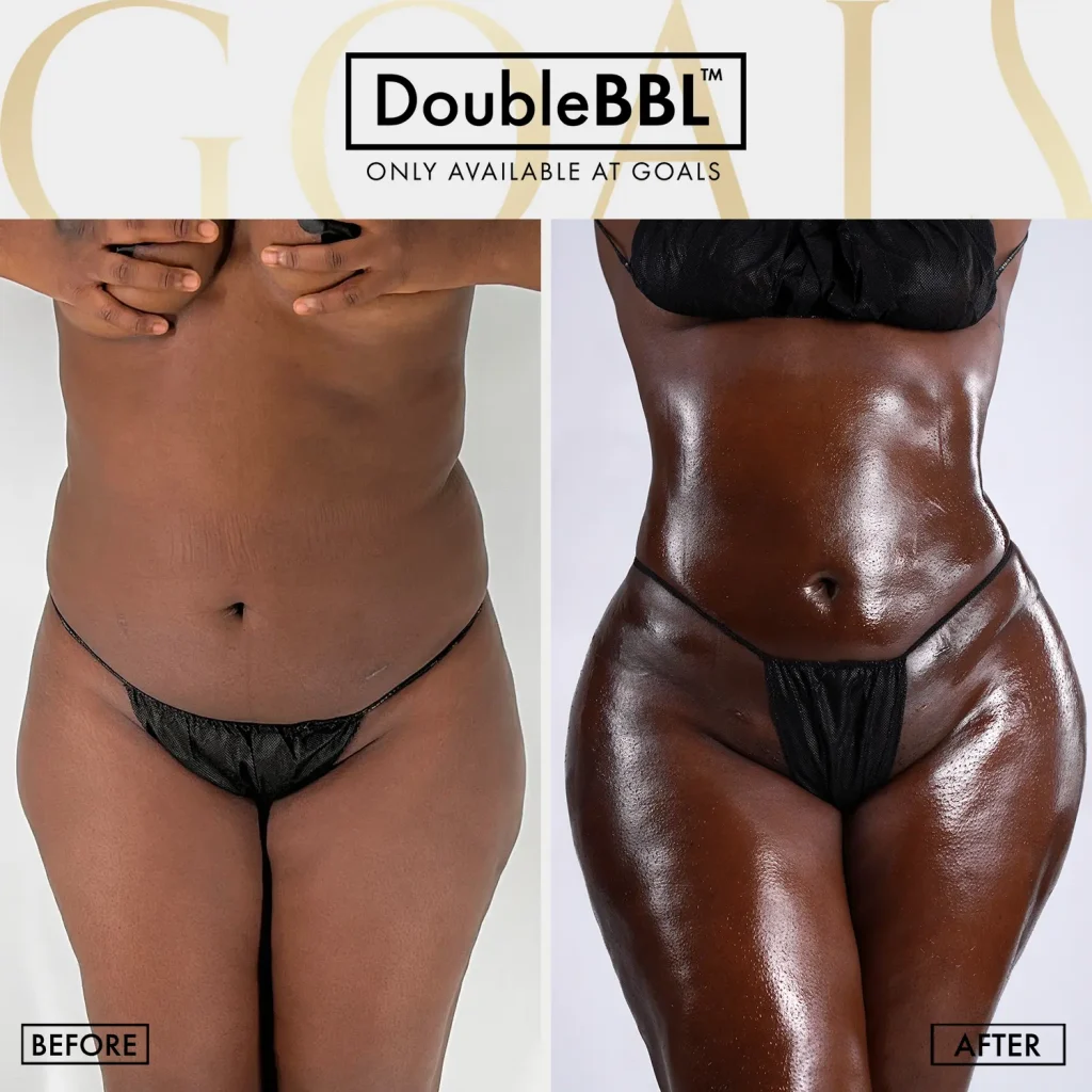 Before and after — Philadelphia, patient 1