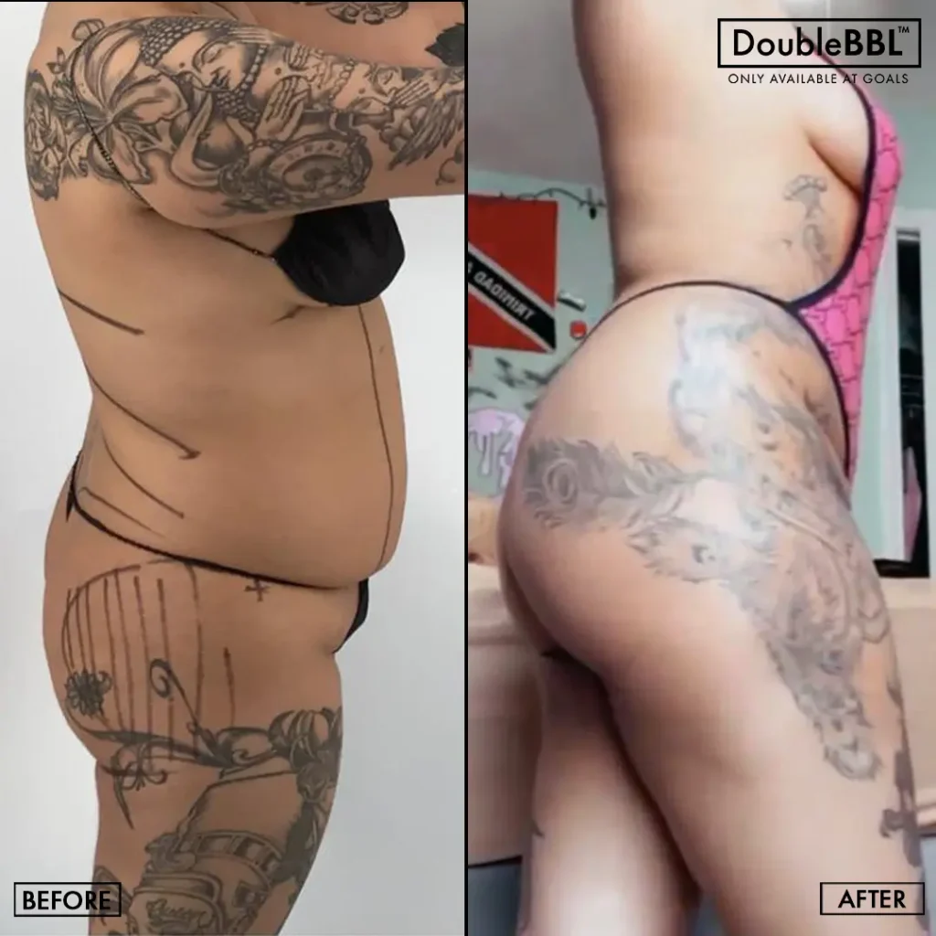Before and after — Philadelphia, patient 2