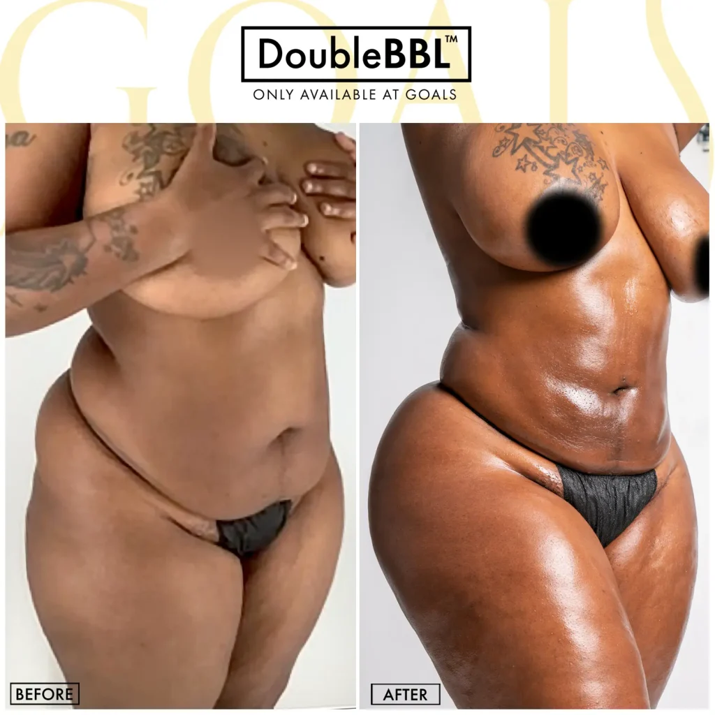 Before and after — Philadelphia, patient 5