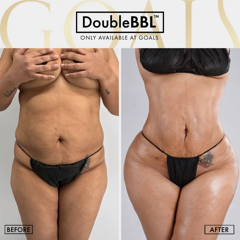 Before and after — Brooklyn, patient 2