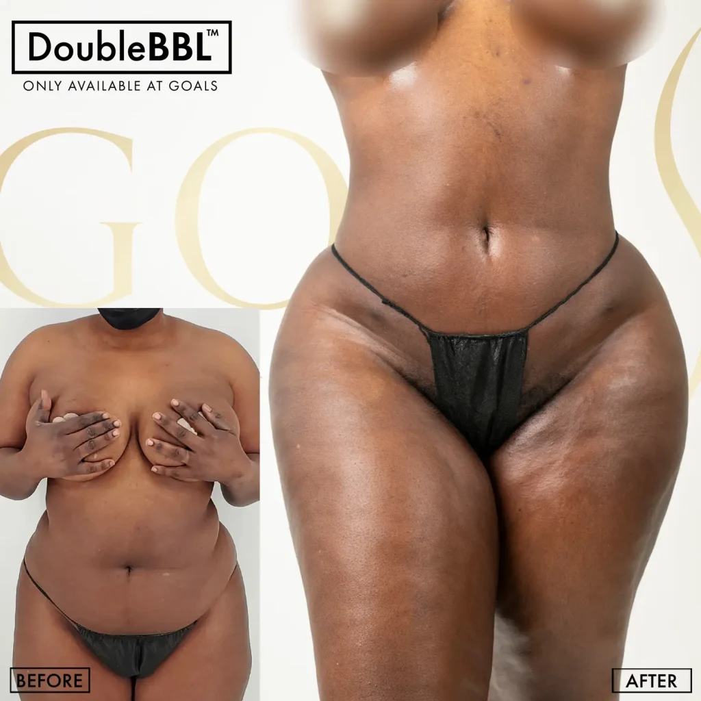 Before and after — Brooklyn, patient 3