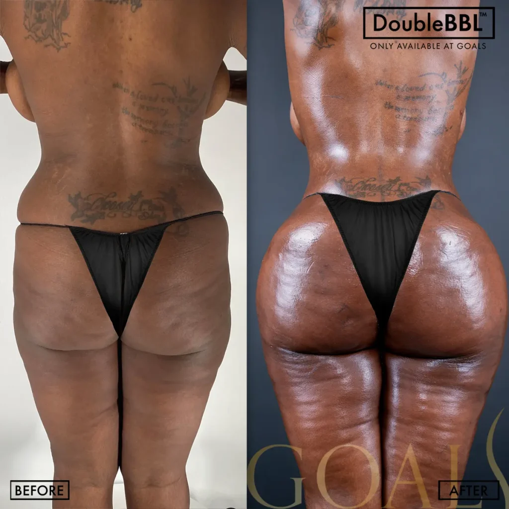 Before and after — Central Park, patient 3