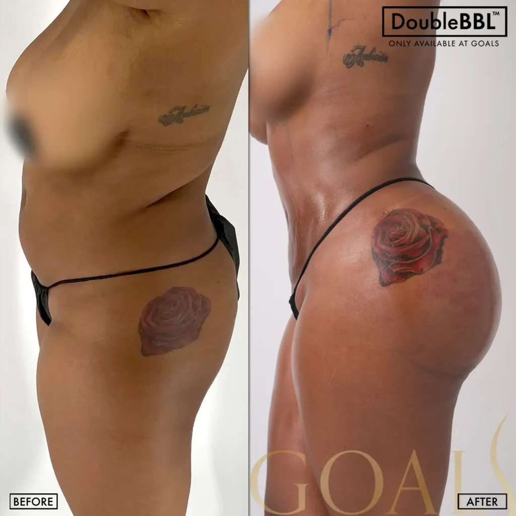 Before and after — Central Park, patient 6