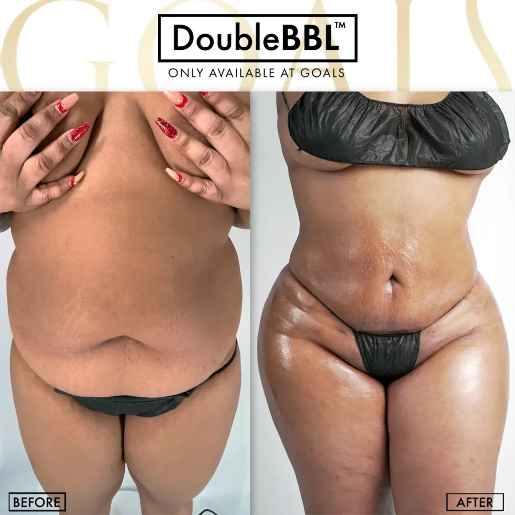 Before and after — Bronx, patient 5