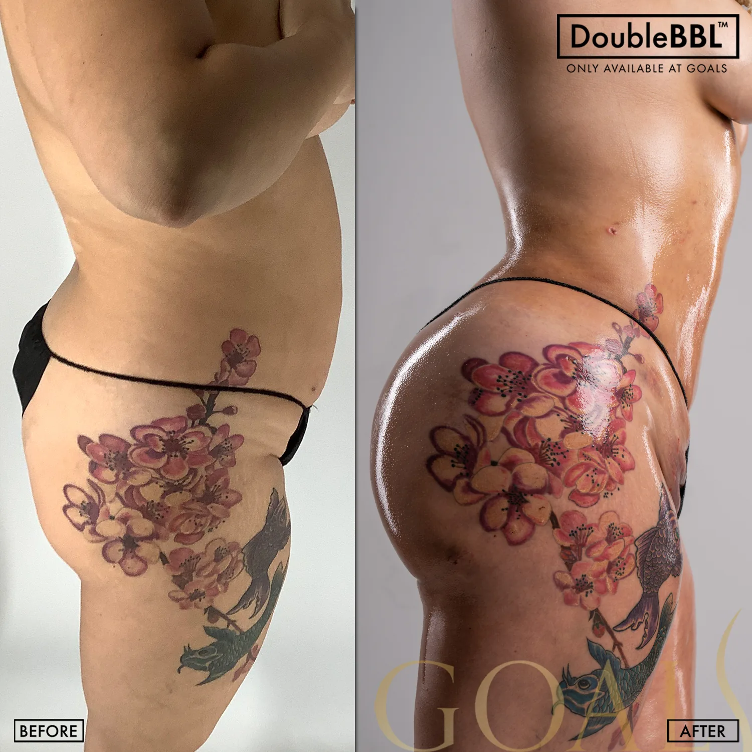 Before and after, patient 5
