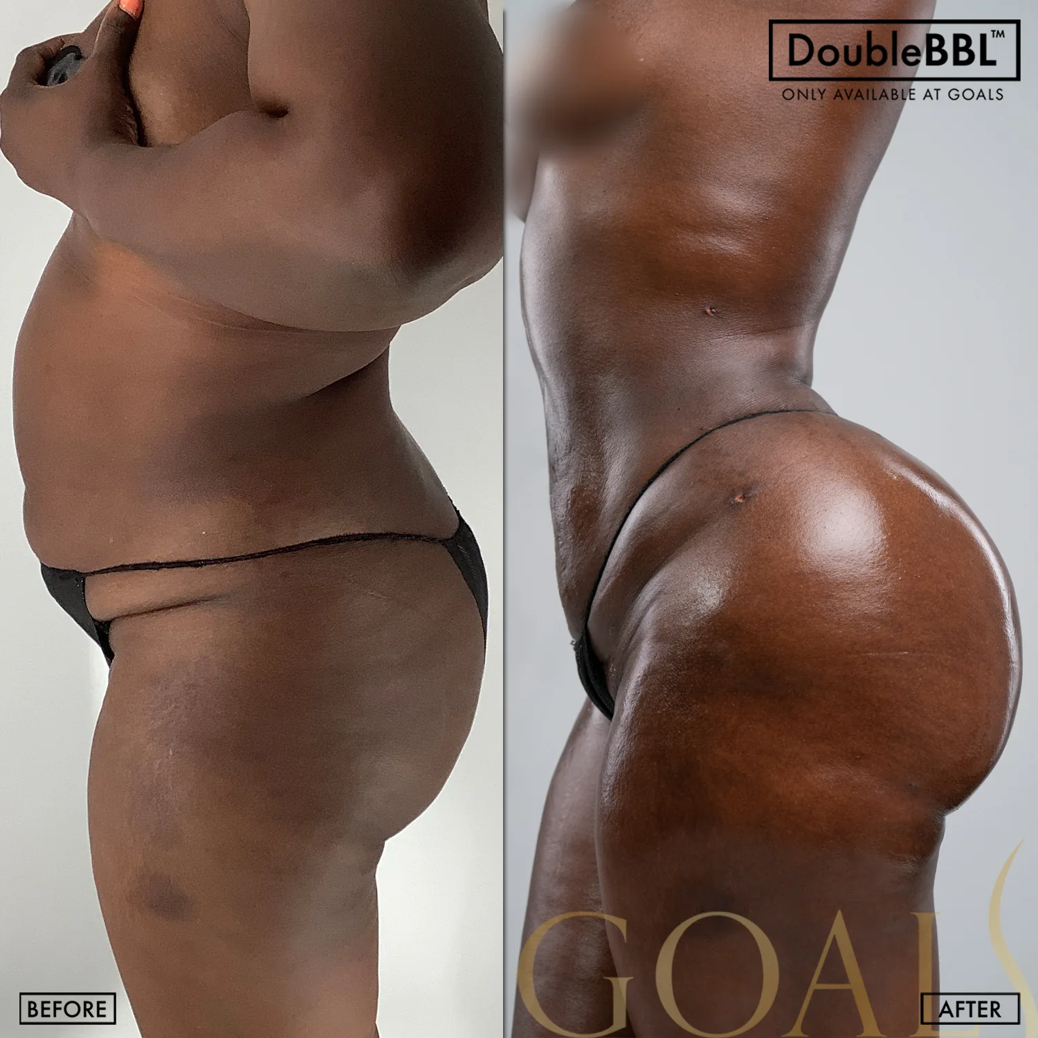 Before and after, patient 4