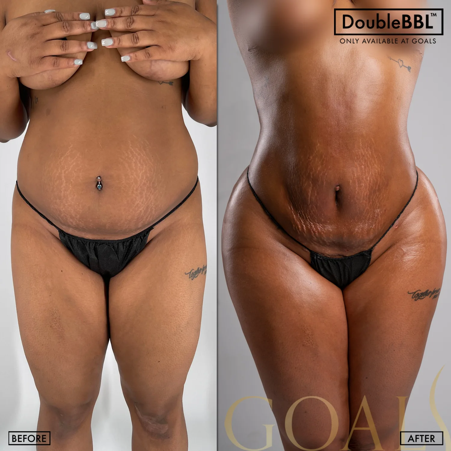 Before and after, patient 6