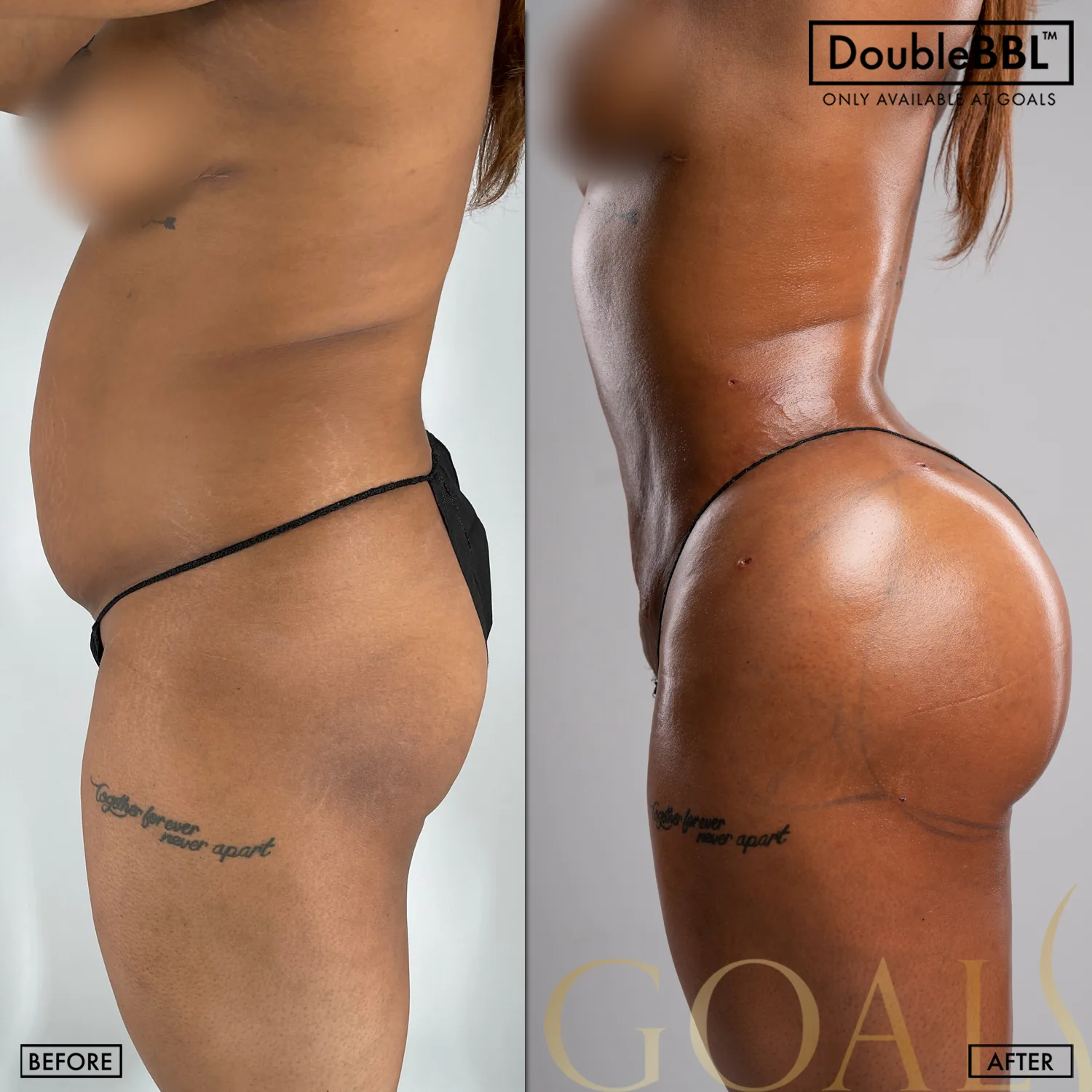 Before and after, patient 3