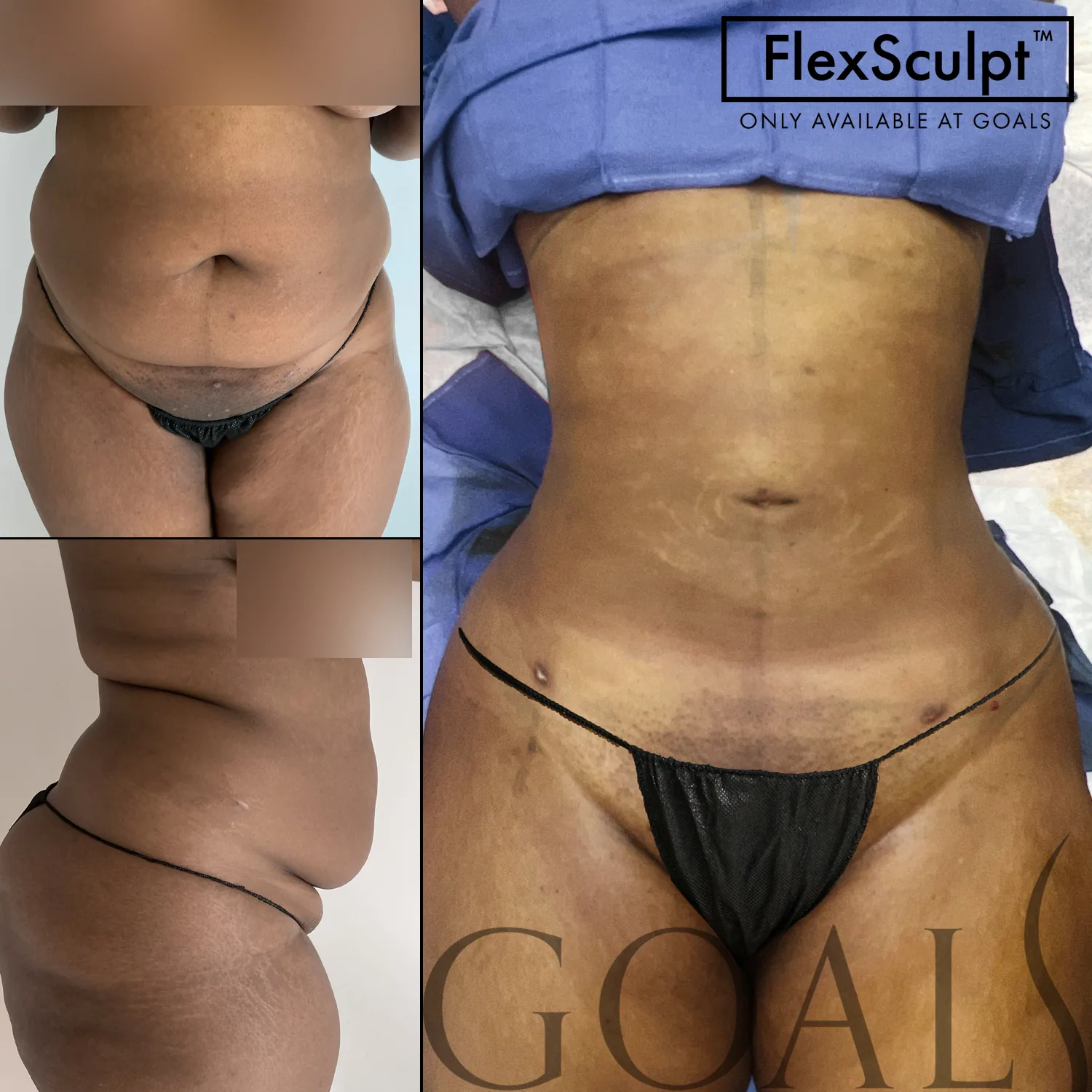 Before and after, patient 1