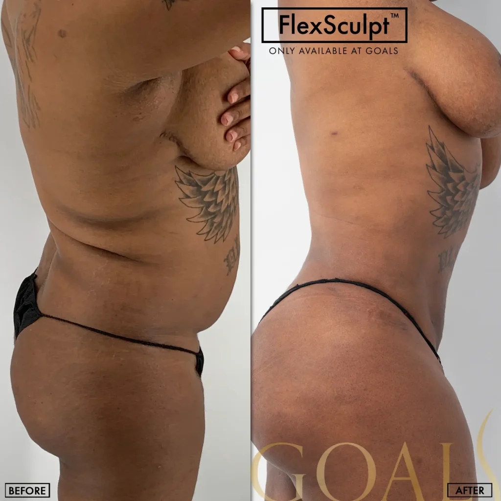 Before and after, patient 2