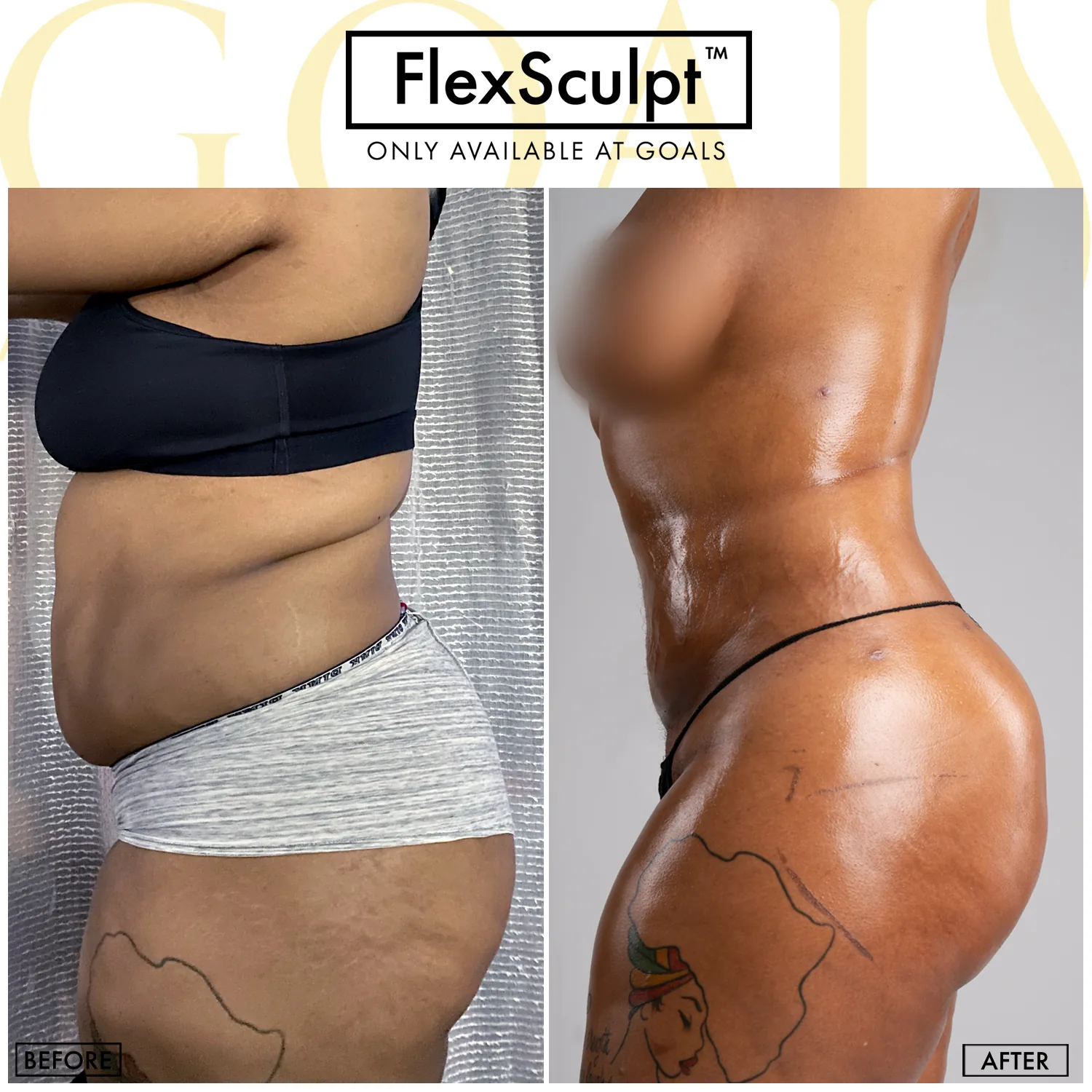 Before and after — Harlem, patient 3