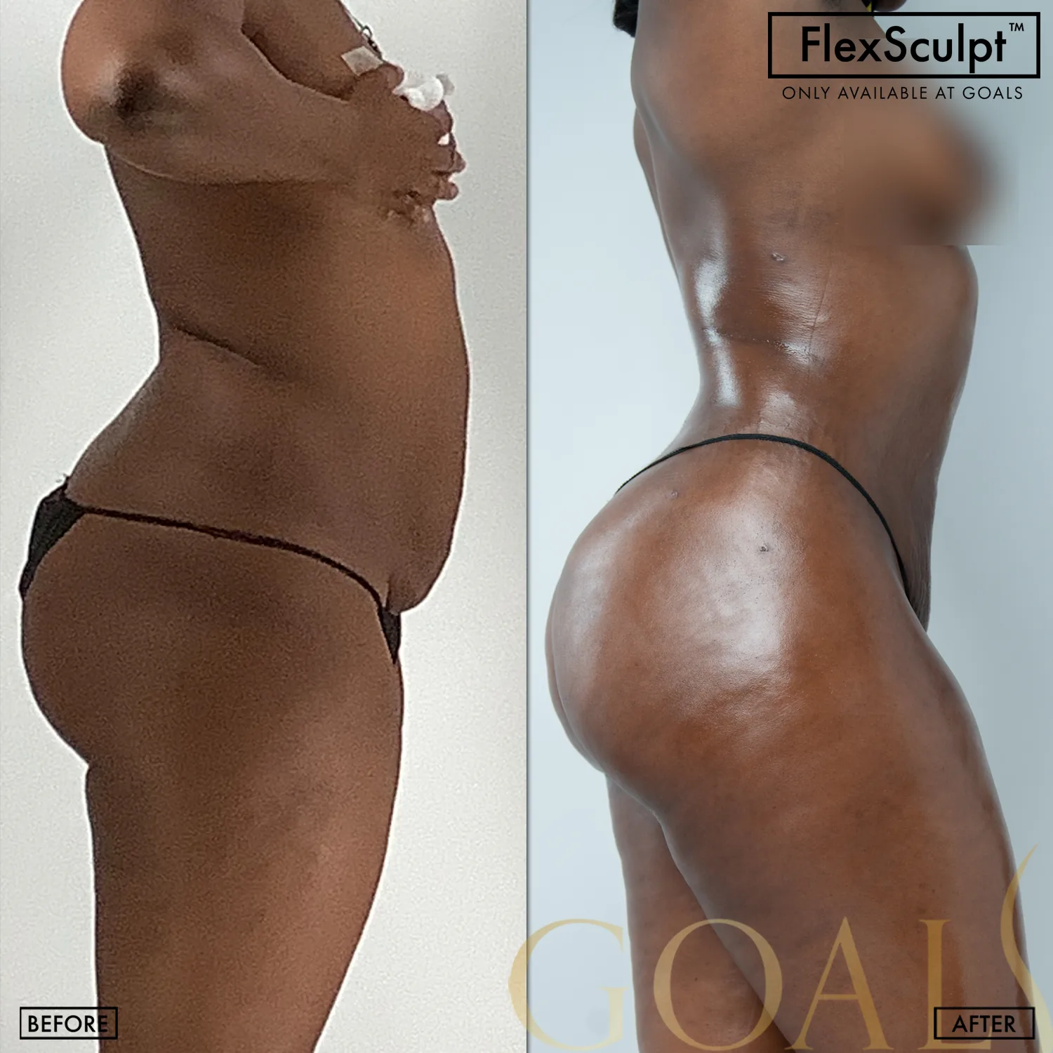 Before and after — Harlem, patient 4