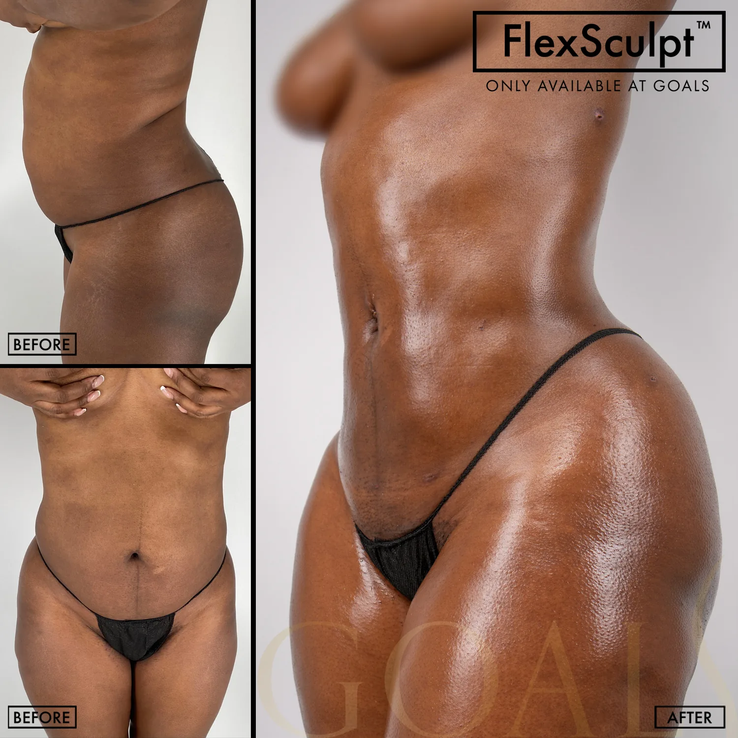 Before and after — Harlem, patient 5