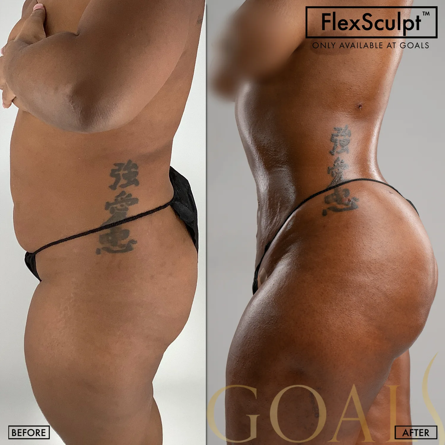 Before and after — Harlem, patient 6