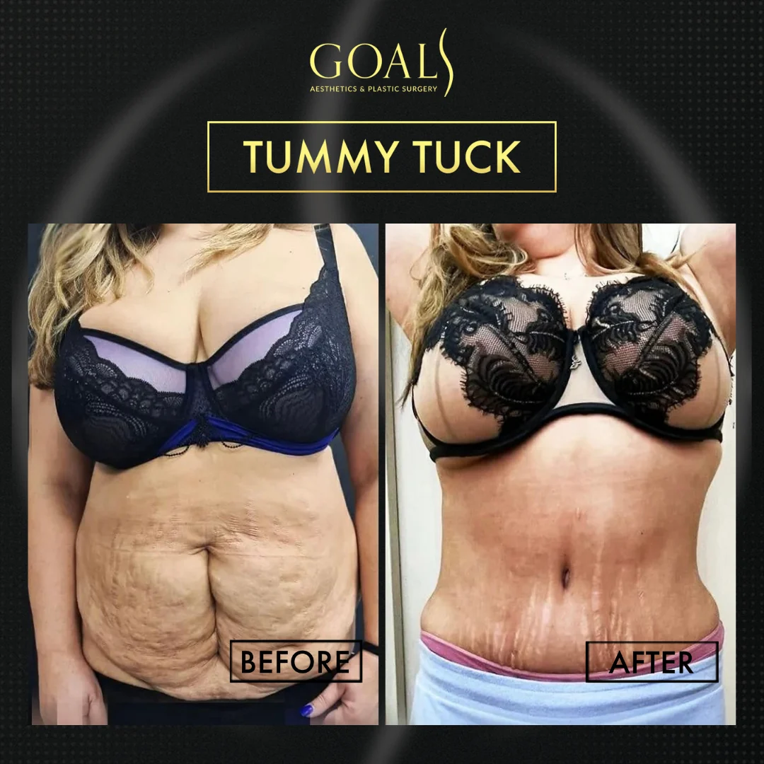 Before and after, patient 6