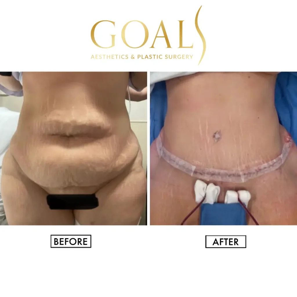 Before and after — Philadelphia, patient 3